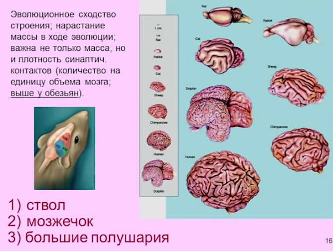 brain1